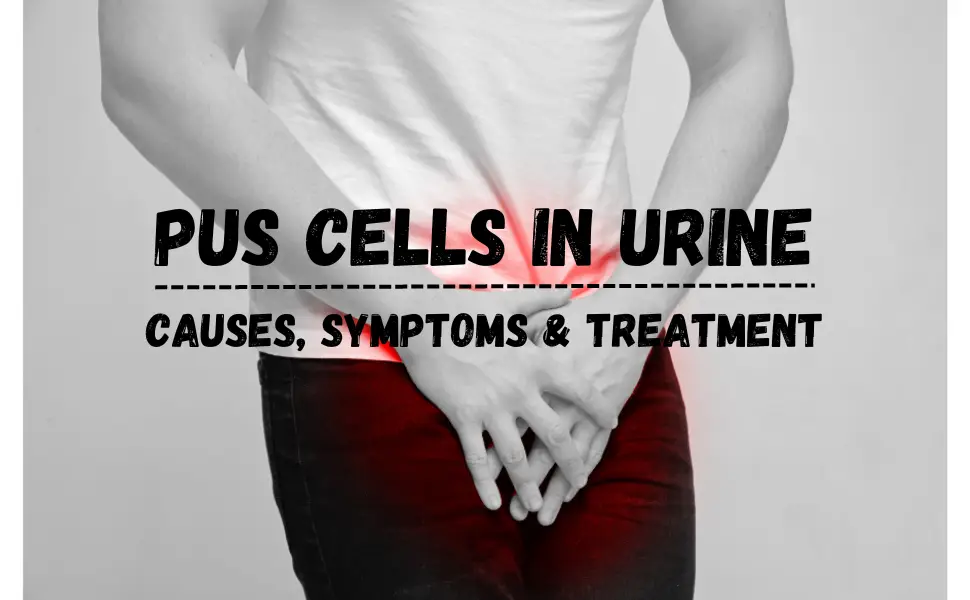 "pus cells in urine"