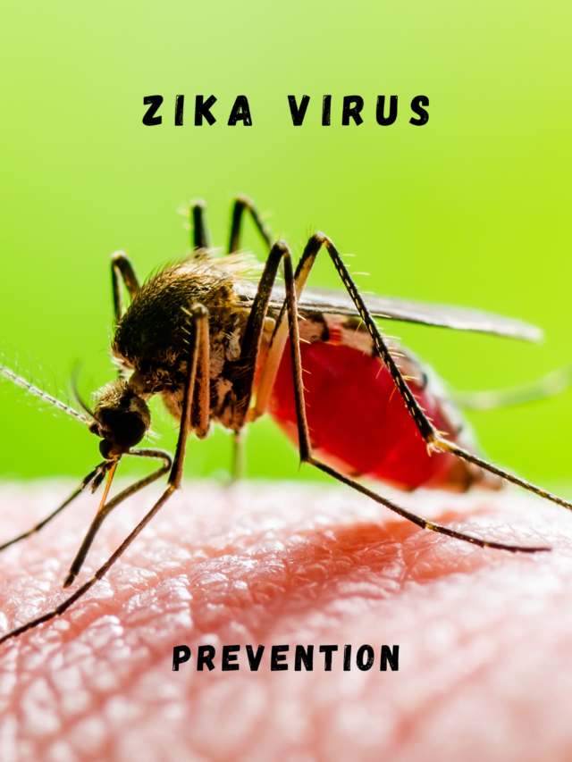 Zika Virus Symptoms and Prevention